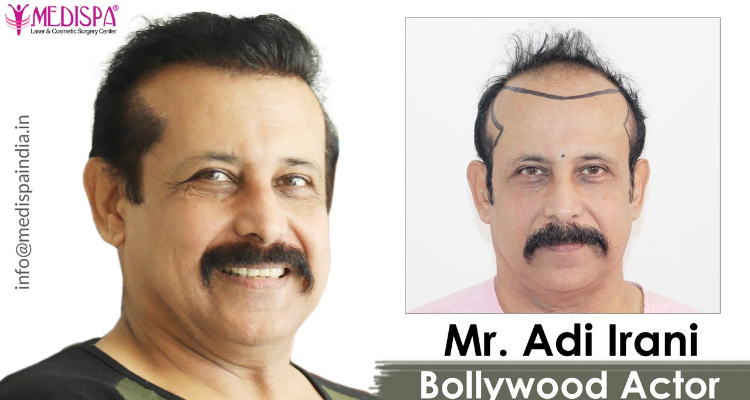 Medispa Hair Transplant Center, Jaipur