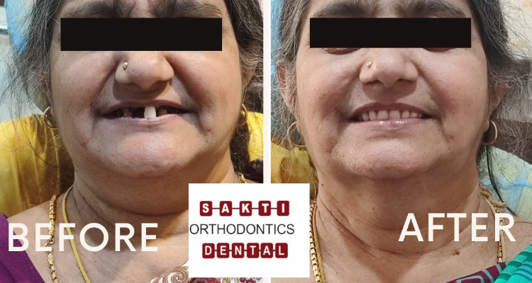 Dental Clinic in Tirunelveli Sakti Dental Orthodontic Clinic