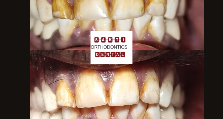 Dental Clinic in Tirunelveli Sakti Dental Orthodontic Clinic