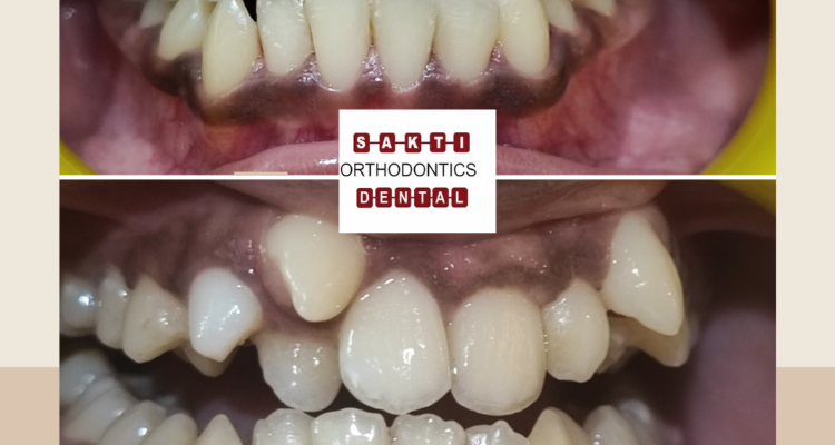Dental Clinic in Tirunelveli Sakti Dental Orthodontic Clinic