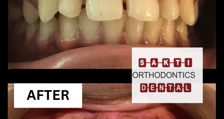 Dental Clinic in Tirunelveli Sakti Dental Orthodontic Clinic