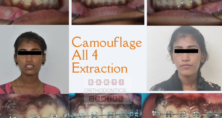 Dental Clinic in Tirunelveli Sakti Dental Orthodontic Clinic