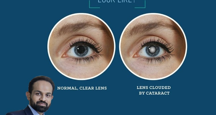 Shubh Eyecare Centre
