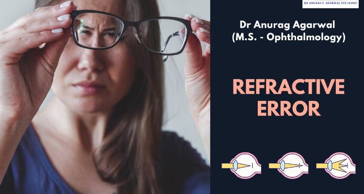 Dr Anurag S Agarwal Eye Clinic
