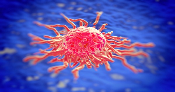 Cancer Specialist Hospital Chandigarh Mohali - Grecian Hospital